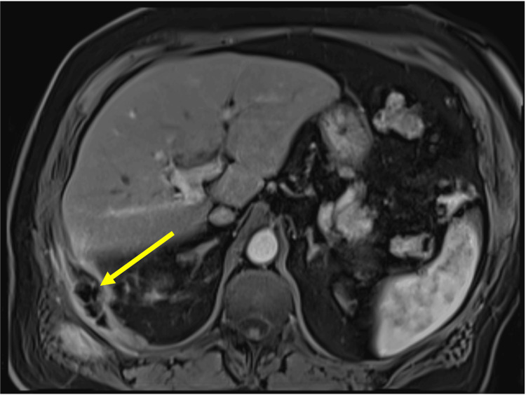 Figure 9