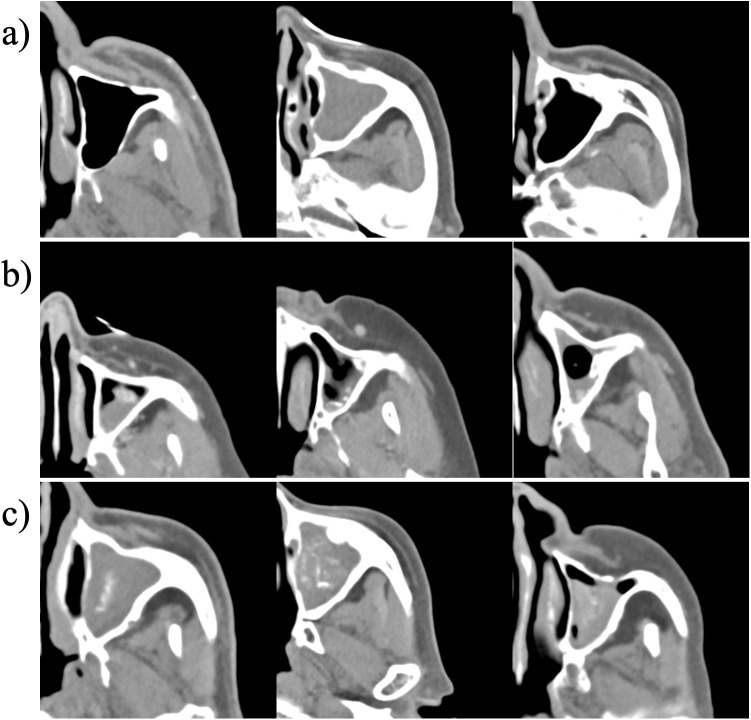 Fig 2