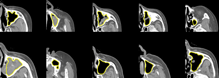 Fig 3