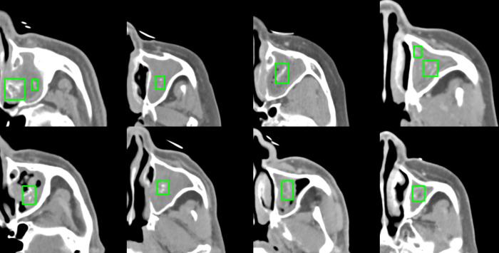 Fig 4