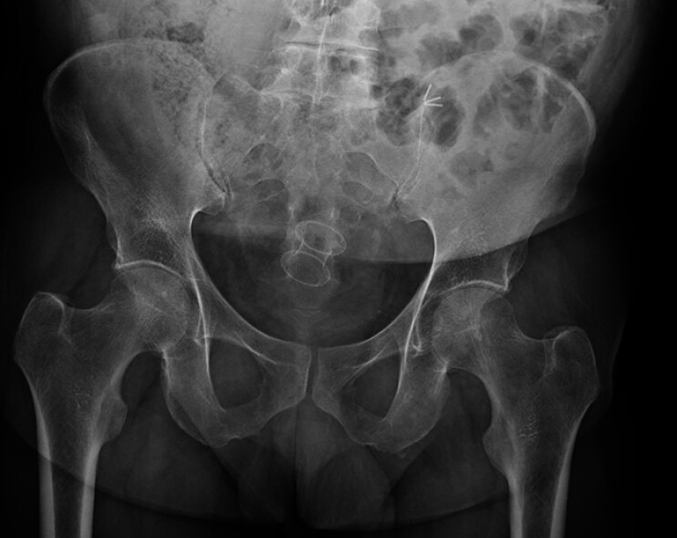 Fig. 3
