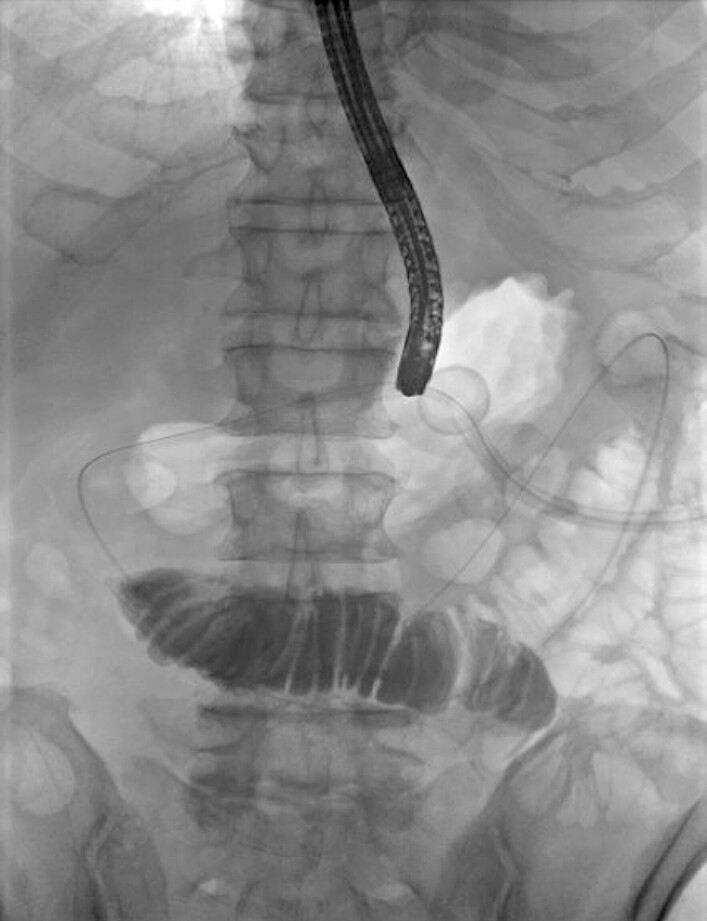 Fig. 2