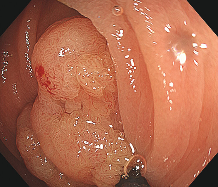 Fig. 1