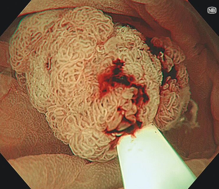 Fig. 3