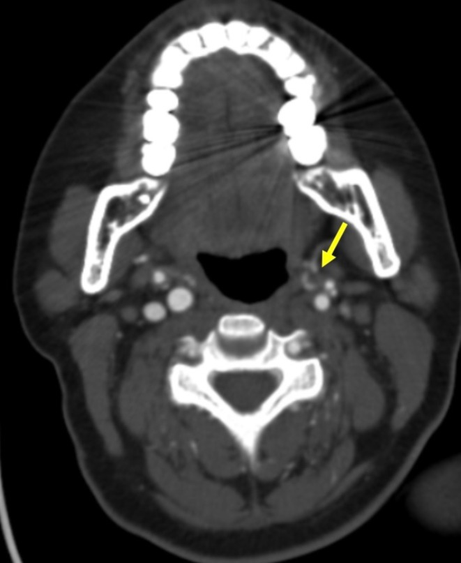 FIGURE 1