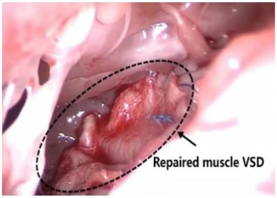 Figure 3