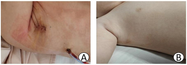 Figure 4