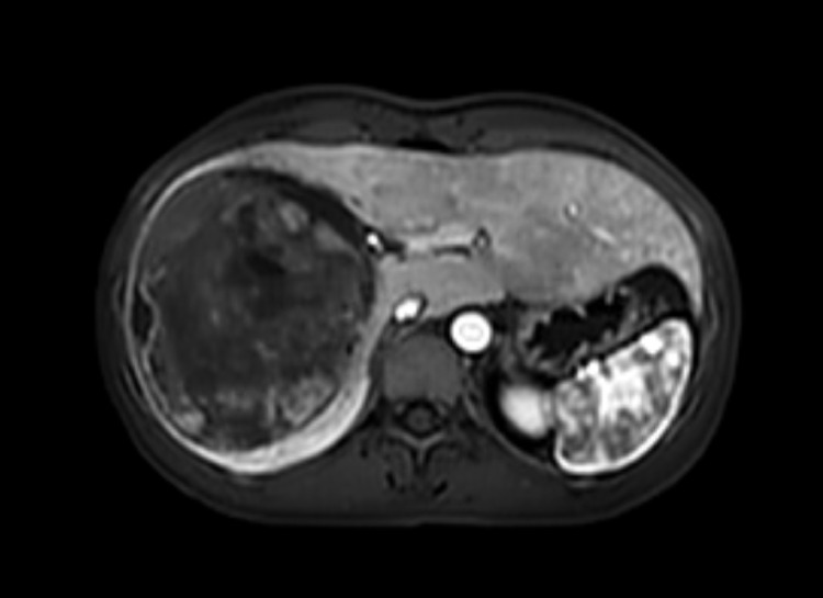 Figure 1
