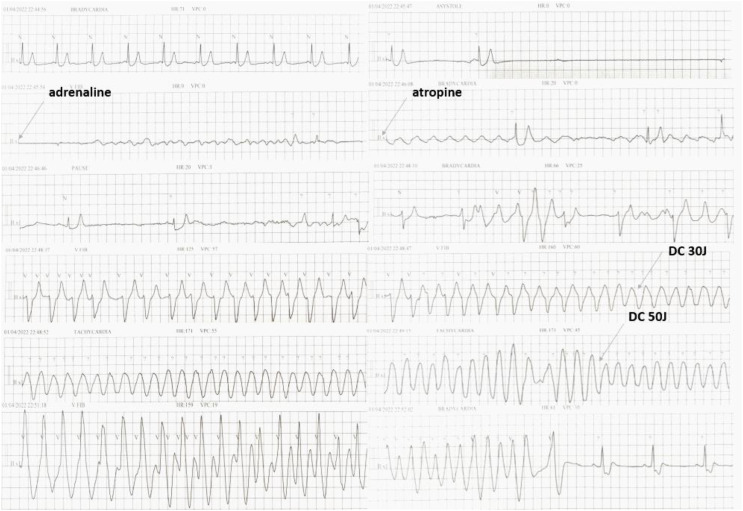 Figure 1