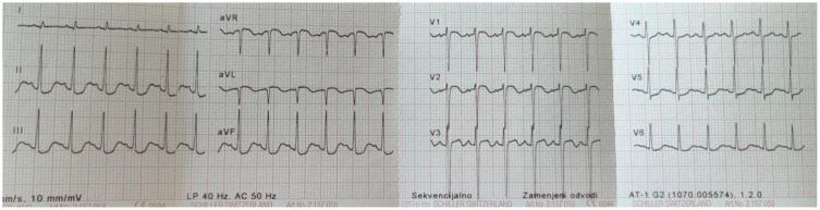 Figure 2