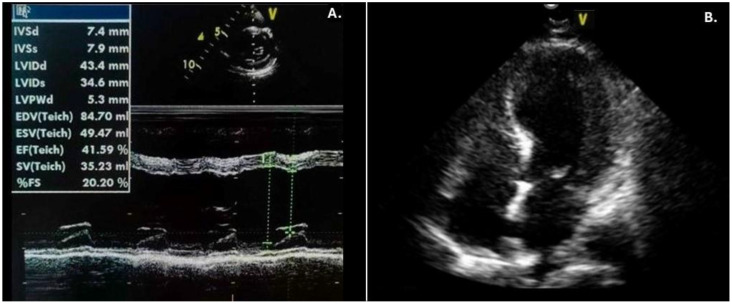 Figure 4