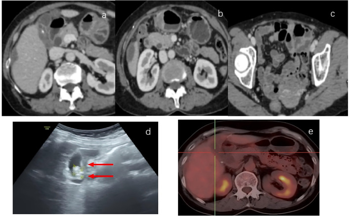 Figure 4