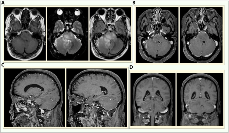 Figure 2