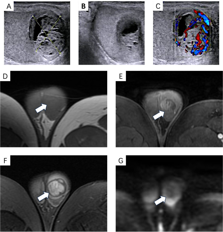 Figure 1
