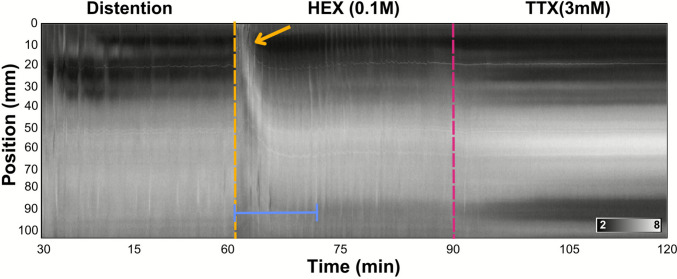Figure 10