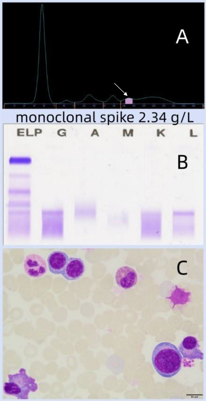 Figure 2