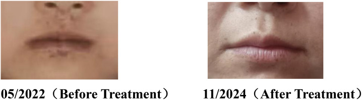 Figure 3