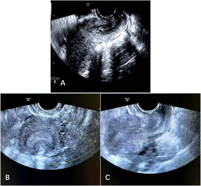 Figure 3