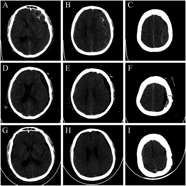 Figure 1