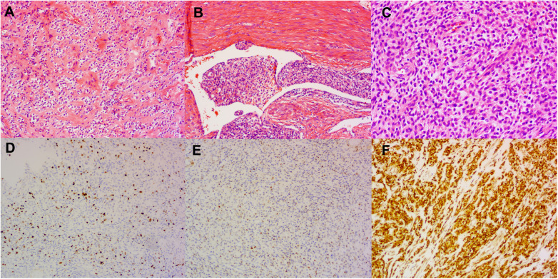 Figure 2