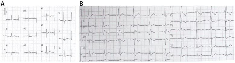 Figure 2