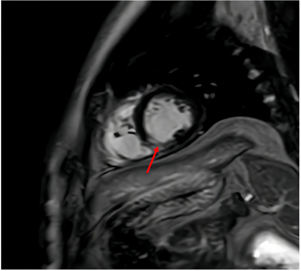 Figure 3