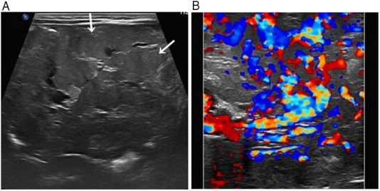 Figure 1