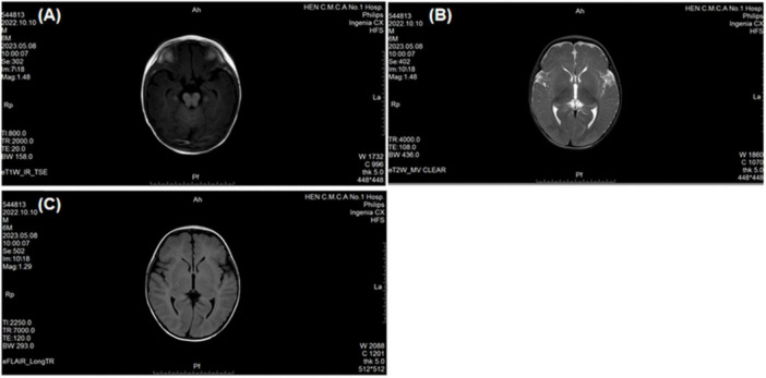 FIGURE 2