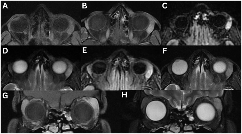 Figure 4