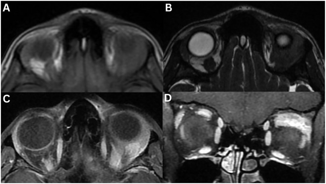 Figure 11