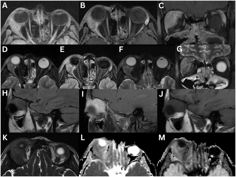 Figure 12