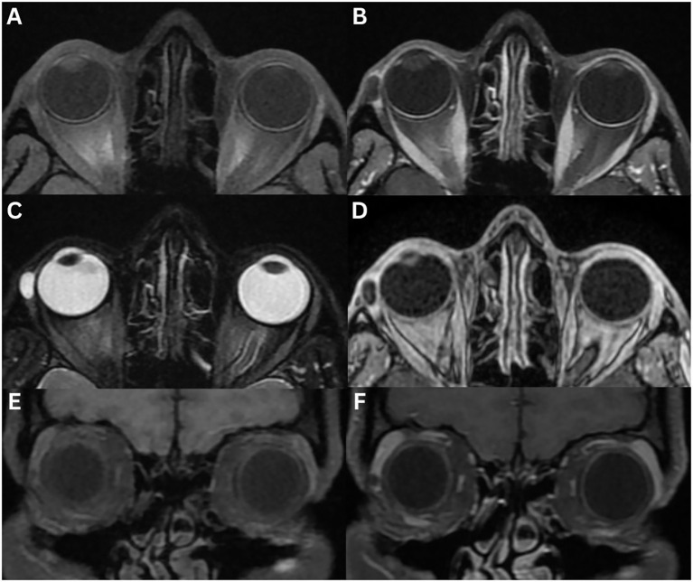 Figure 13