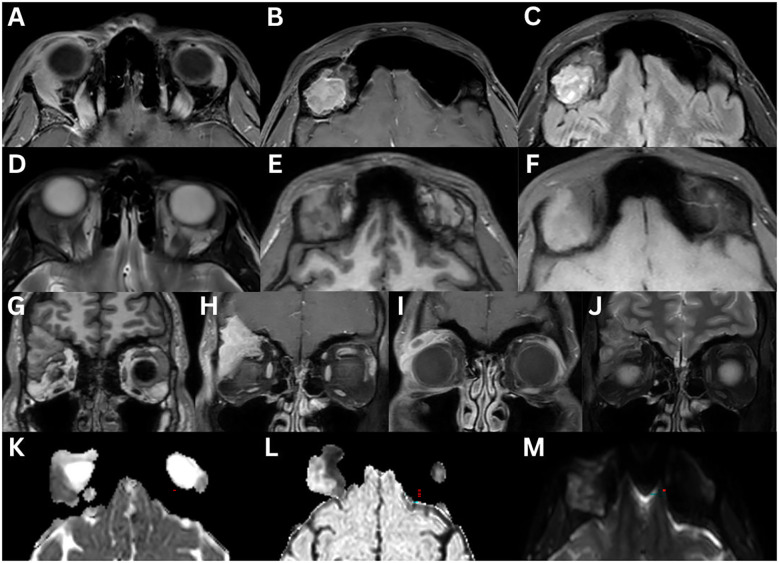 Figure 14