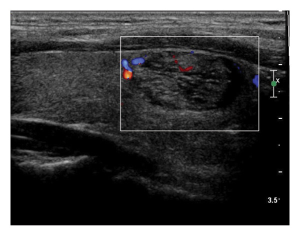 Figure 4