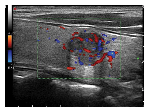 Figure 6