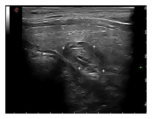 Figure 15