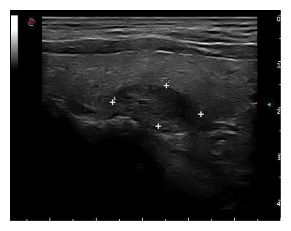 Figure 16