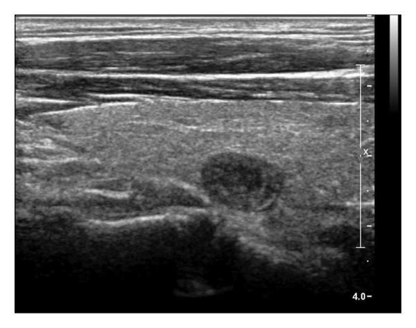 Figure 17