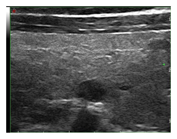 Figure 18