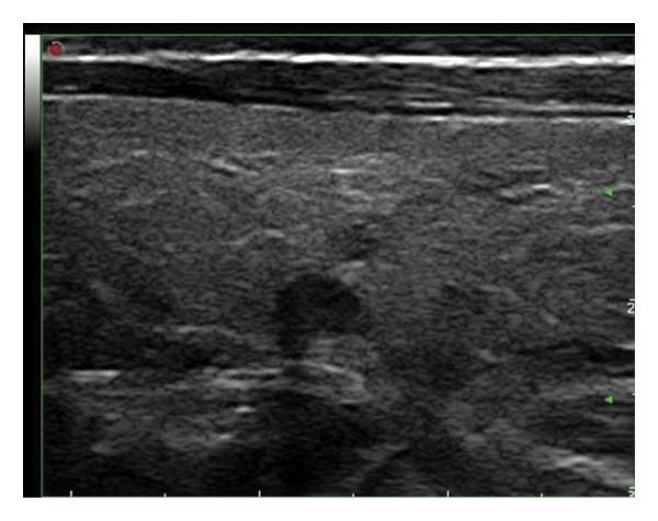 Figure 19