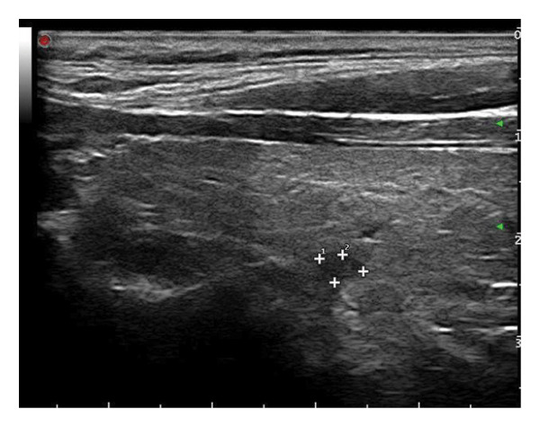 Figure 20