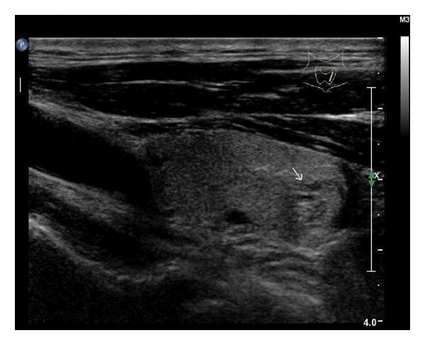 Figure 21