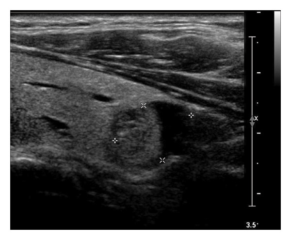 Figure 22