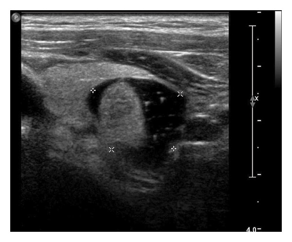 Figure 23