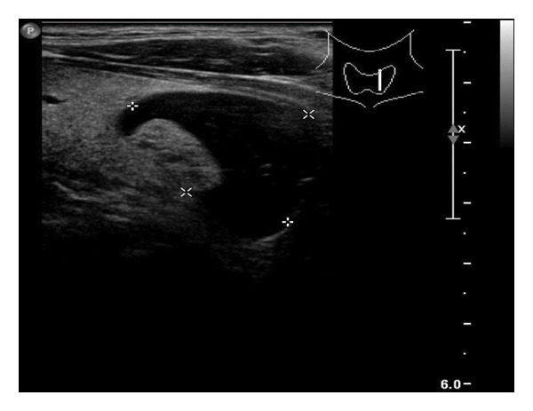 Figure 24