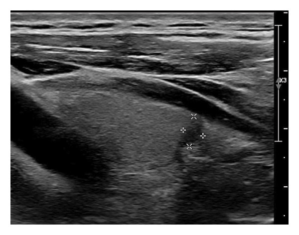 Figure 25