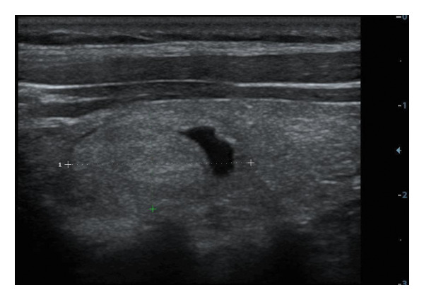 Figure 26