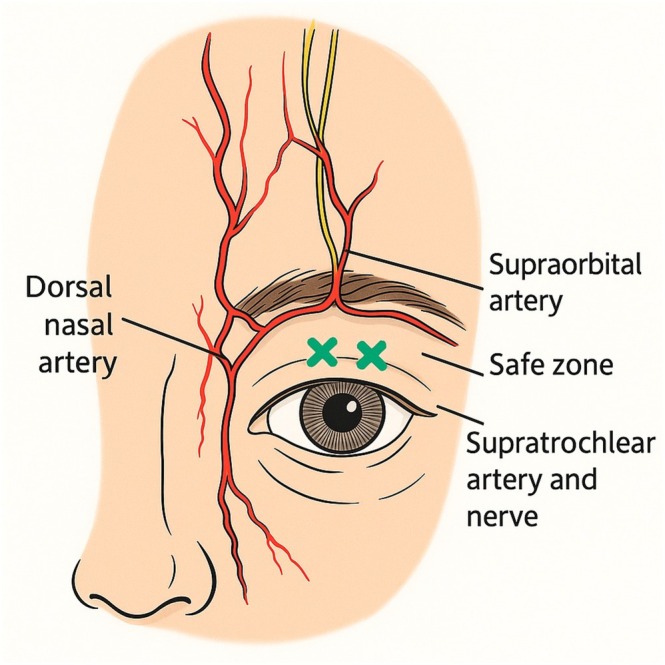 FIGURE 3