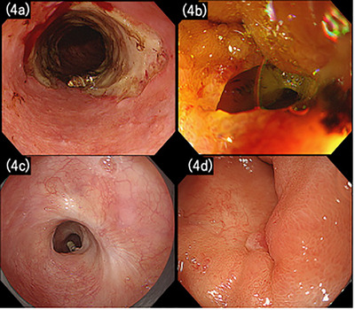 FIGURE 4