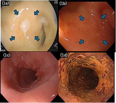 FIGURE 1
